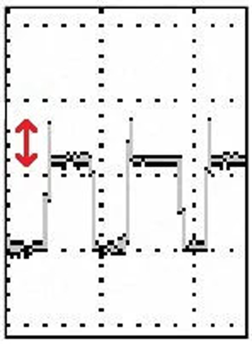 Pantalla de osciloscopio que muestra la magnitud de los reflejos